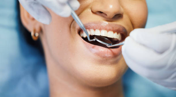 Trusted OH Emergency Dental Service Experts
